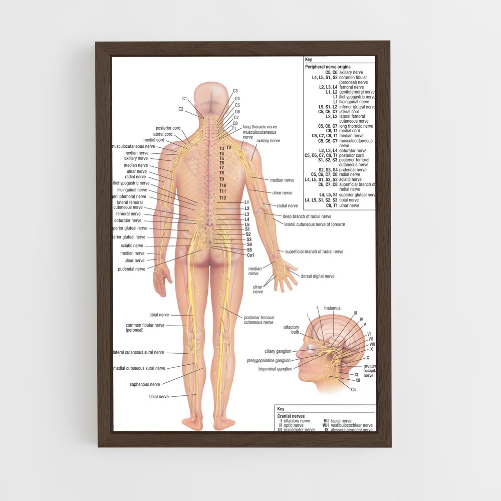 ap-nerve-1 cadre Bois foncé