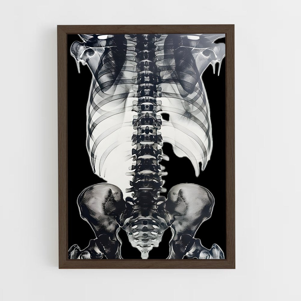ap-skeleton-5 cadre Bois foncé