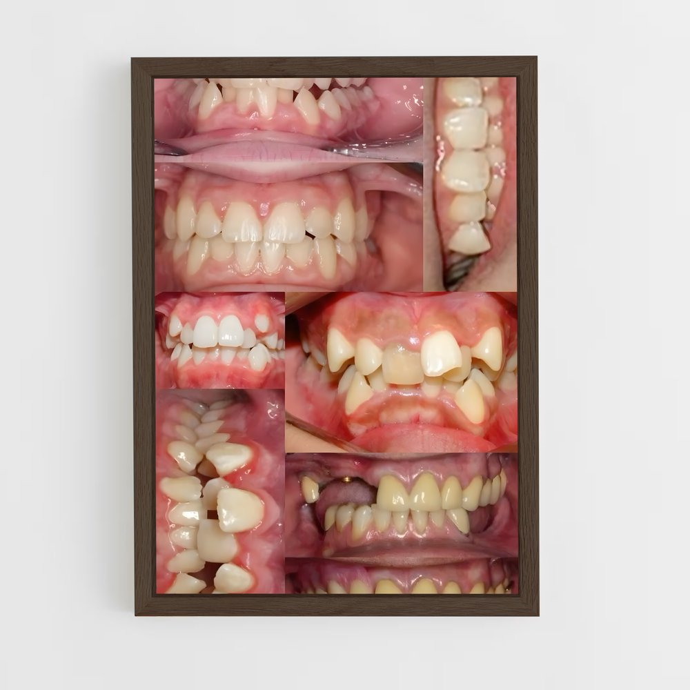 ap-teeth-1 cadre Bois foncé