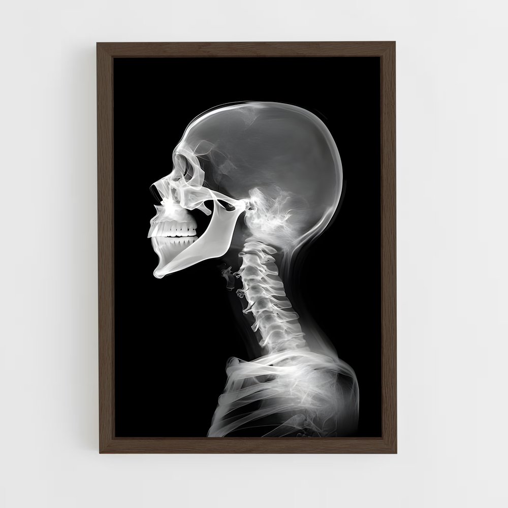 ap-x-rays-1 cadre Bois foncé