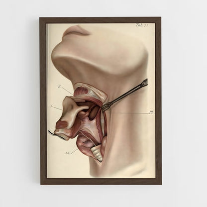 ap-anatomy-1 cadre Bois foncé
