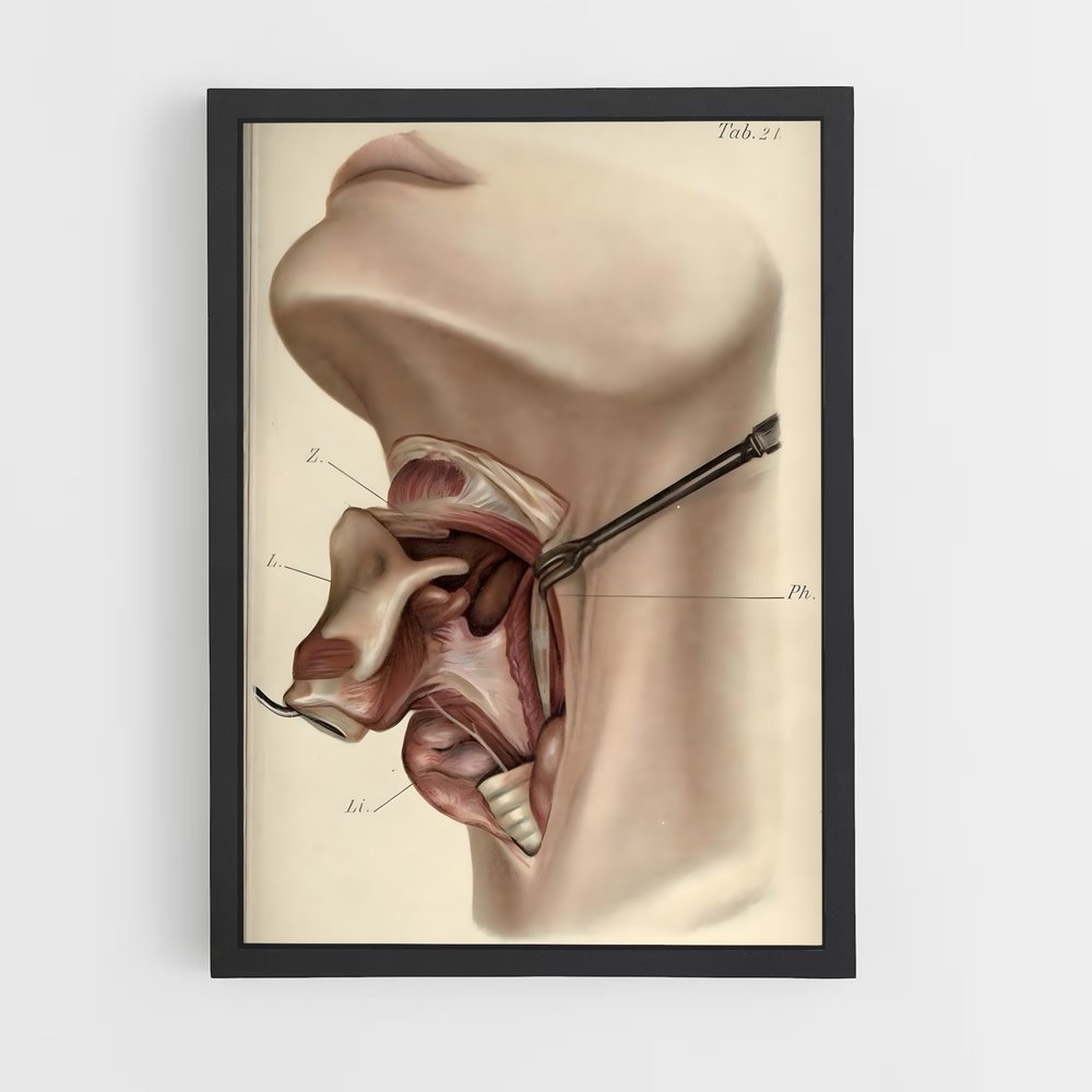 ap-anatomy-1 cadre Noir