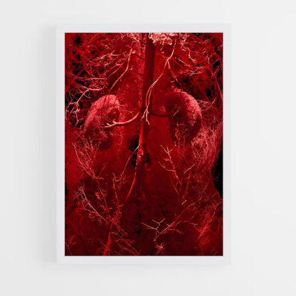 ap-artery-4 cadre Blanc