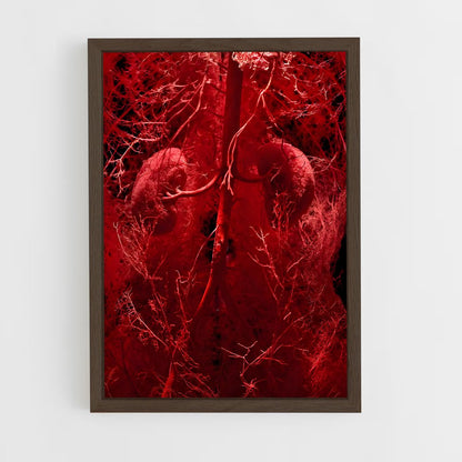 ap-artery-4 cadre Bois foncé