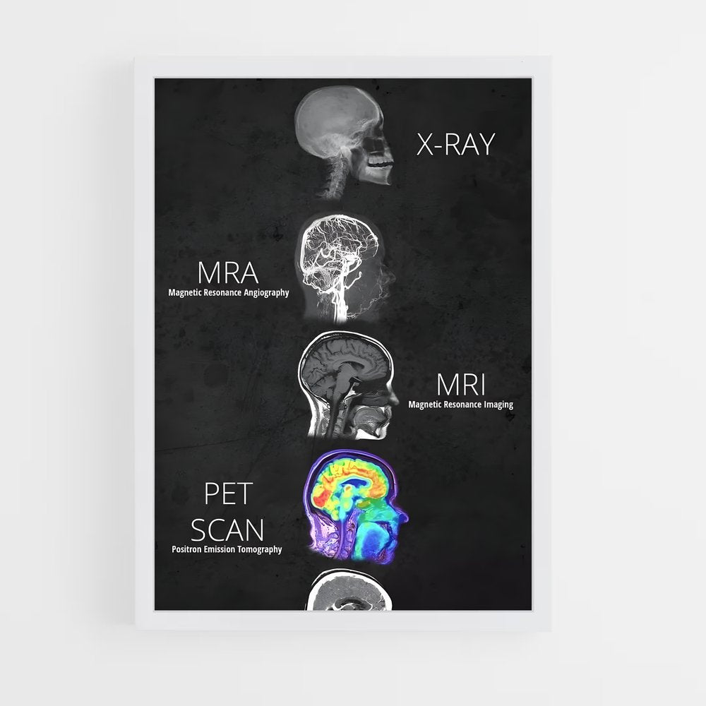 ap-brain anatomy-2 cadre Blanc