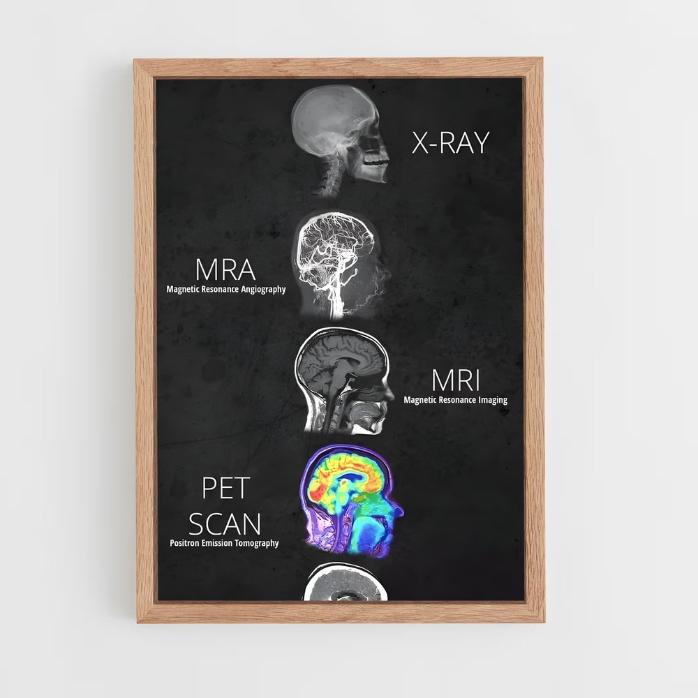ap-brain anatomy-2 cadre Bois clair