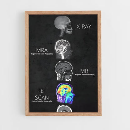 ap-brain anatomy-2 cadre Bois clair