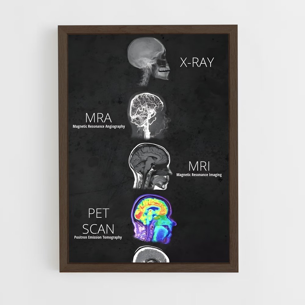 ap-brain anatomy-2 cadre Bois foncé