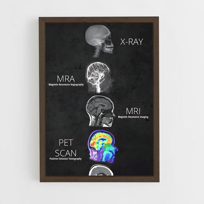 ap-brain anatomy-2 cadre Bois foncé