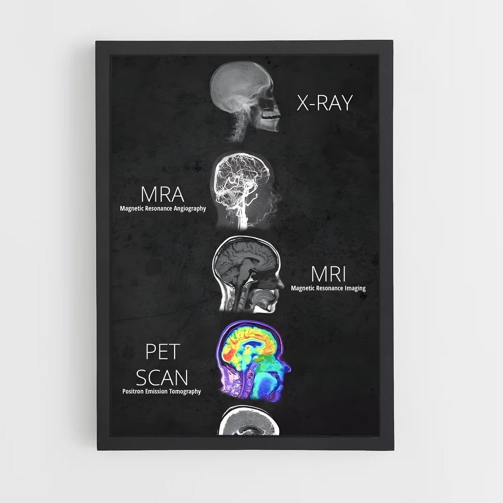 ap-brain anatomy-2 cadre Noir