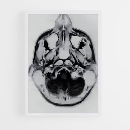 ap-brain scan-2 cadre Blanc