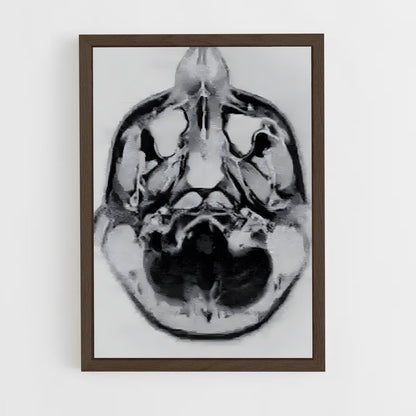 ap-brain scan-2 cadre Bois foncé