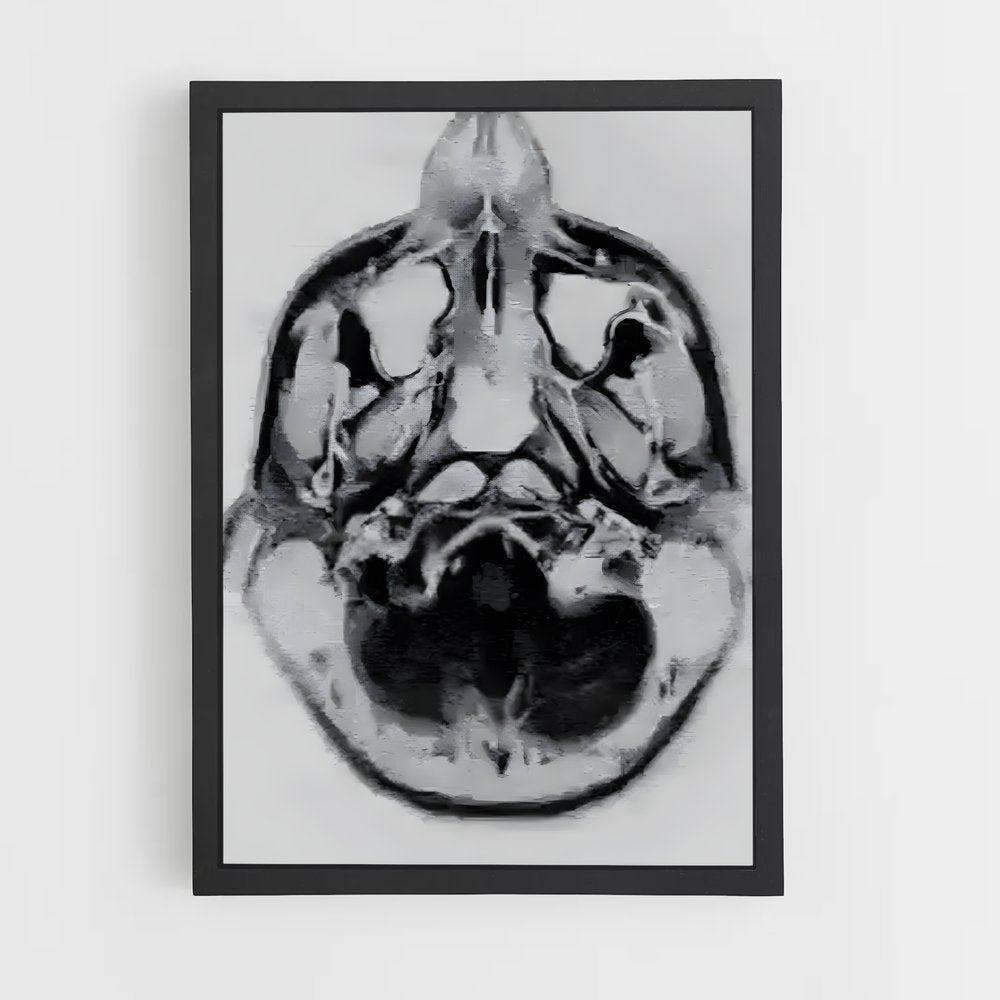 ap-brain scan-2 cadre Noir