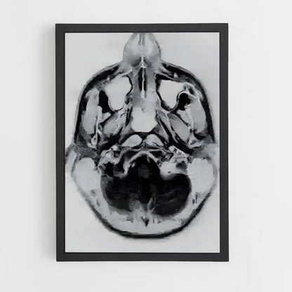 ap-brain scan-2 cadre Noir