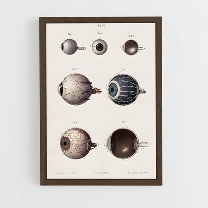 ap-eye anatomy-1 cadre Bois foncé