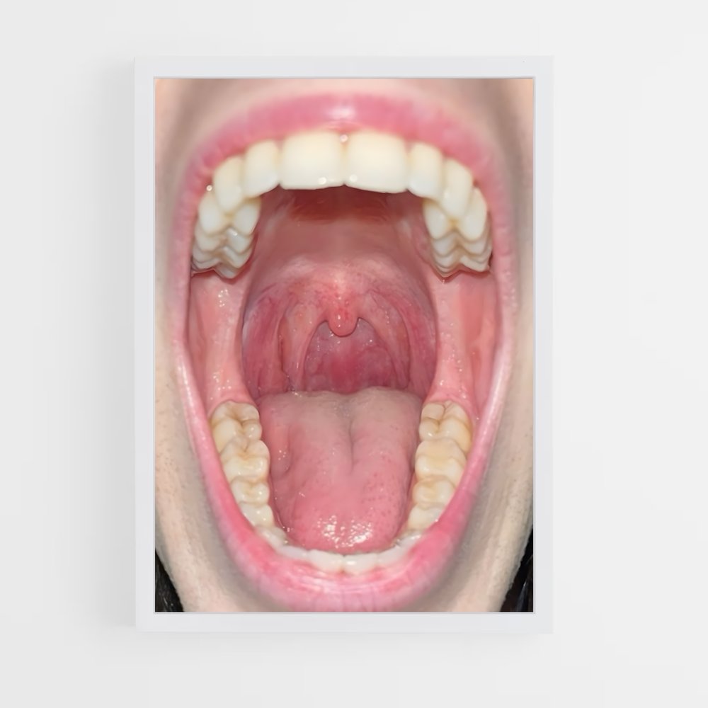 ap-mouth-1 cadre Blanc