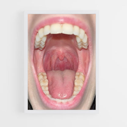ap-mouth-1 cadre Blanc