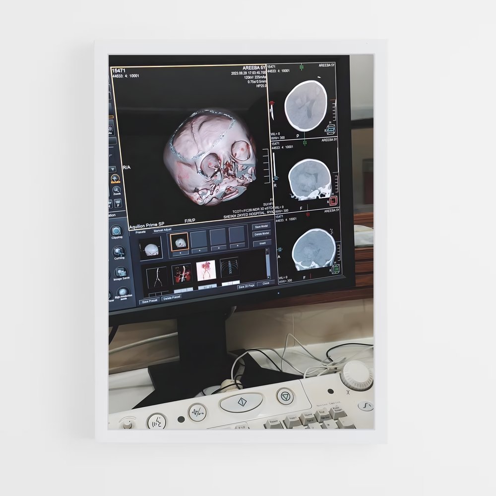 ap-mri machine-4 cadre Blanc