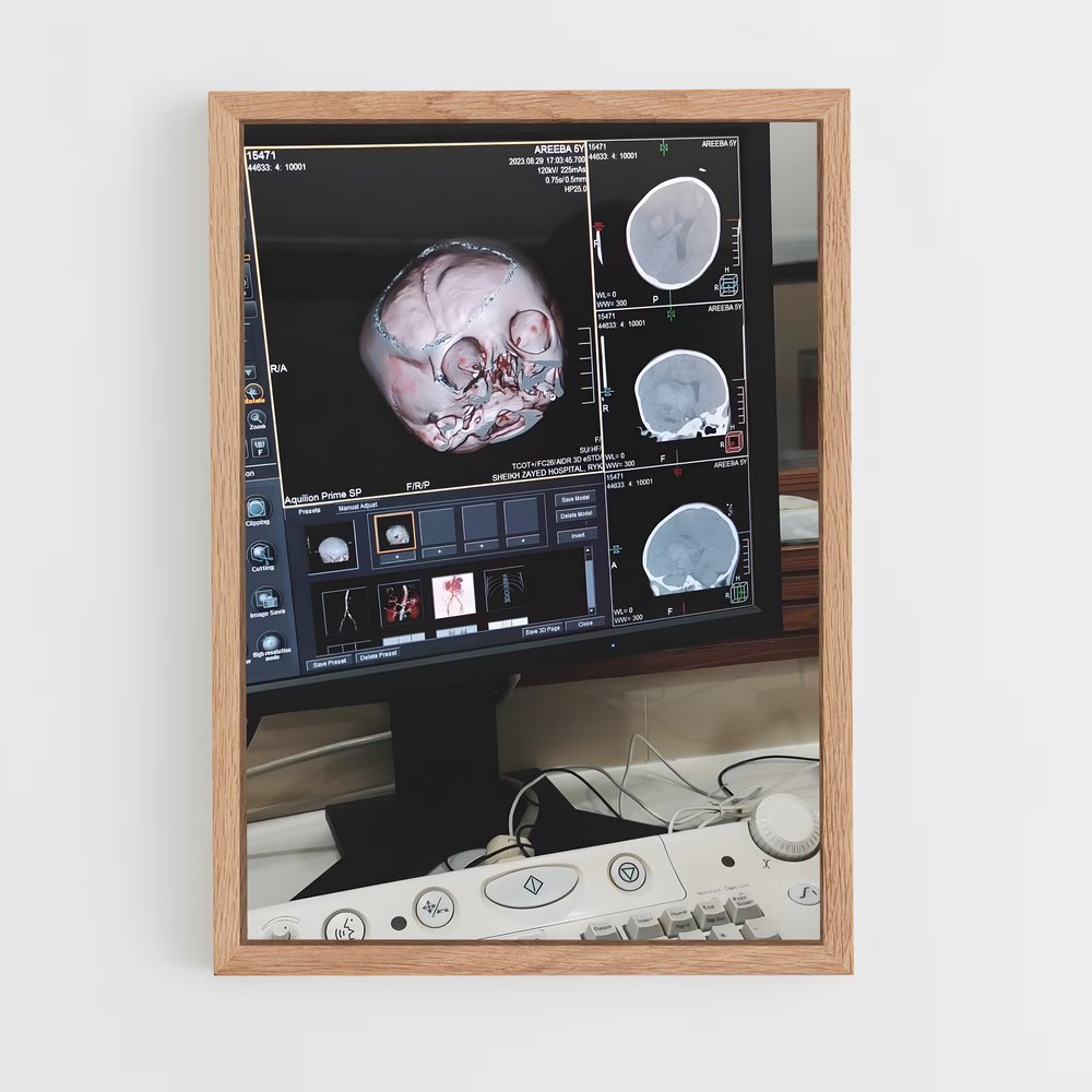 ap-mri machine-4 cadre Bois clair