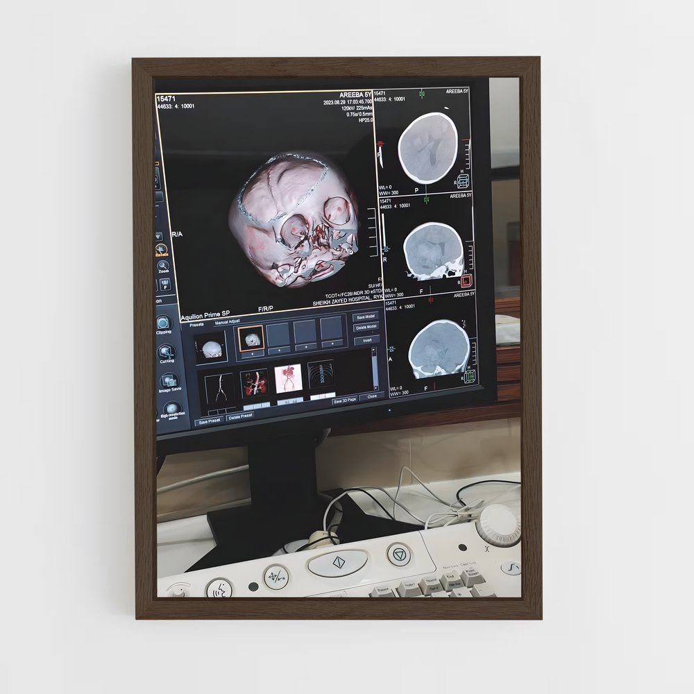 ap-mri machine-4 cadre Bois foncé