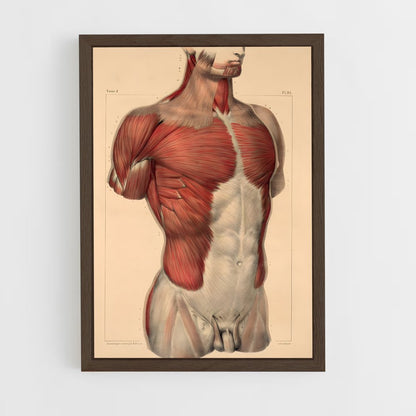 ap-muscle-2 cadre Bois foncé