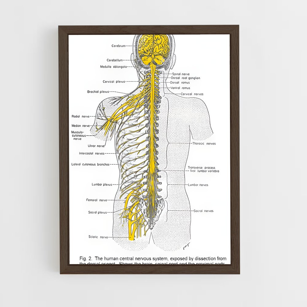 ap-nerve-2 cadre Bois foncé