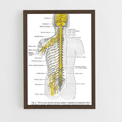 ap-nerve-2 cadre Bois foncé