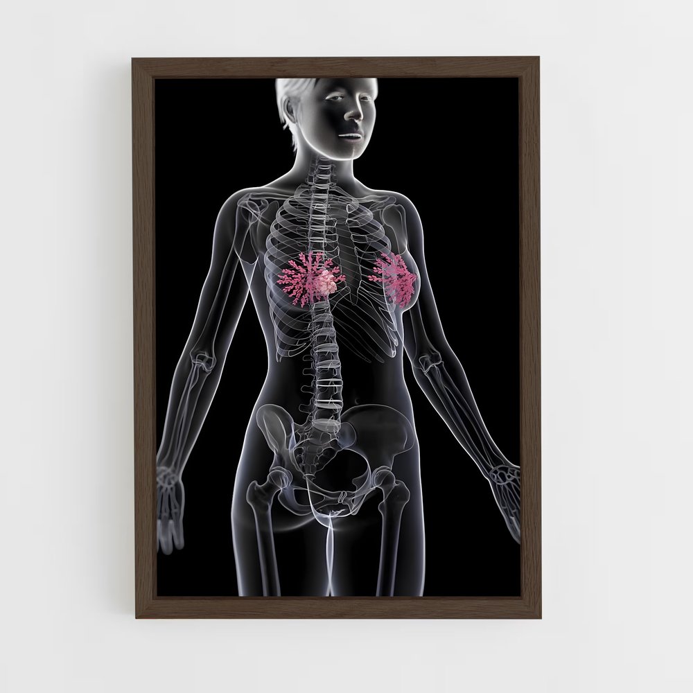 ap-nipple-1 cadre Bois foncé