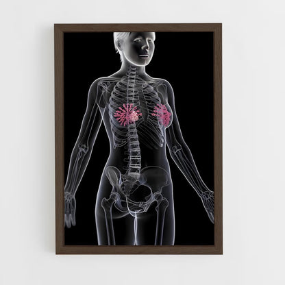 ap-nipple-1 cadre Bois foncé