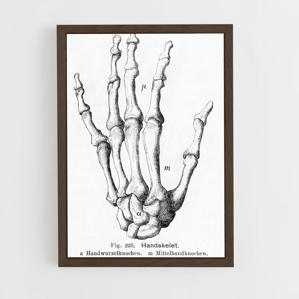 ap-palm-2 cadre Bois foncé