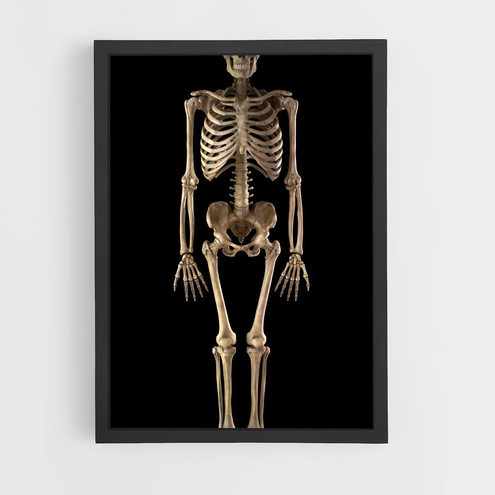 ap-skeleton-2 cadre Noir
