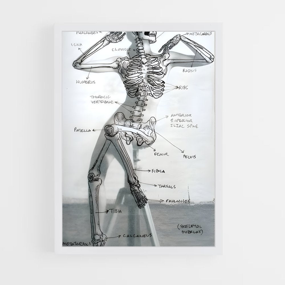 ap-skeleton-3 cadre Blanc