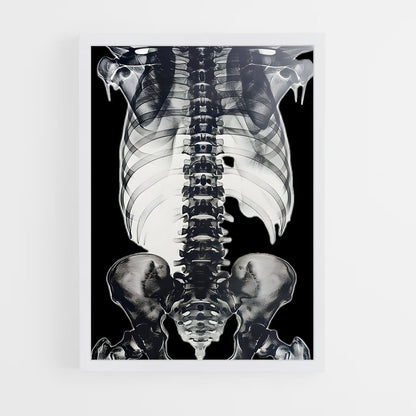 ap-skeleton-5 cadre Blanc