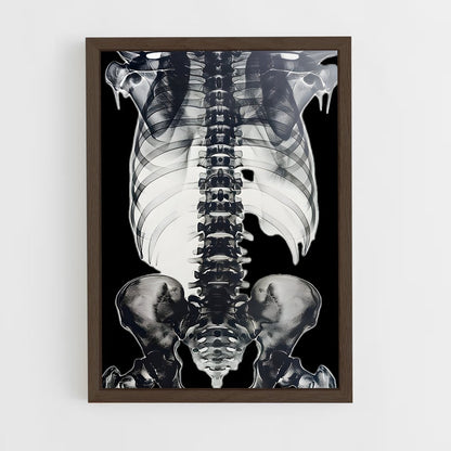 ap-skeleton-5 cadre Bois foncé