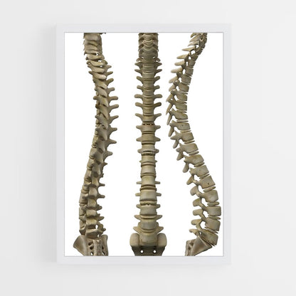 ap-spine-1 cadre Blanc