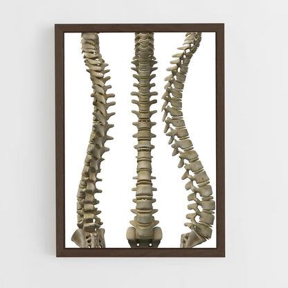 ap-spine-1 cadre Bois foncé