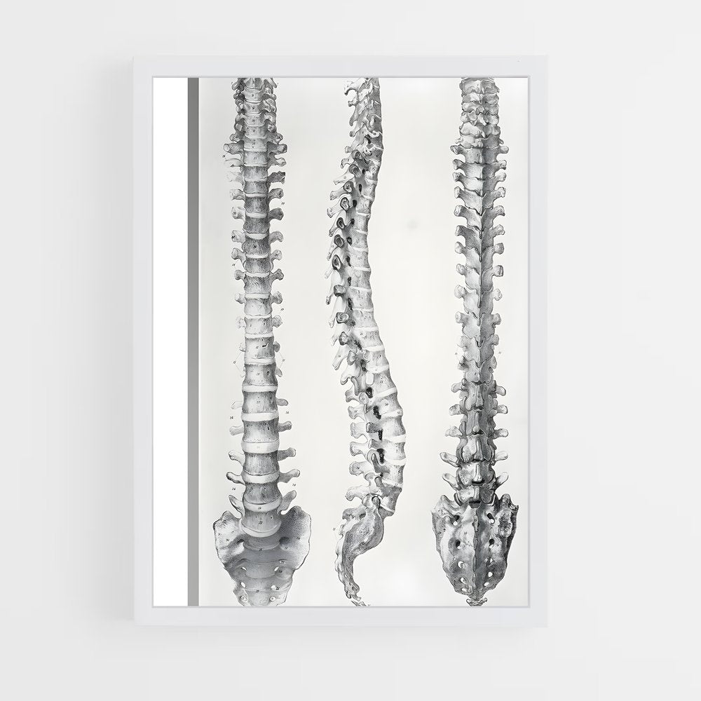 ap-spine-11 cadre Blanc