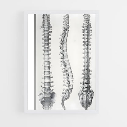 ap-spine-11 cadre Blanc