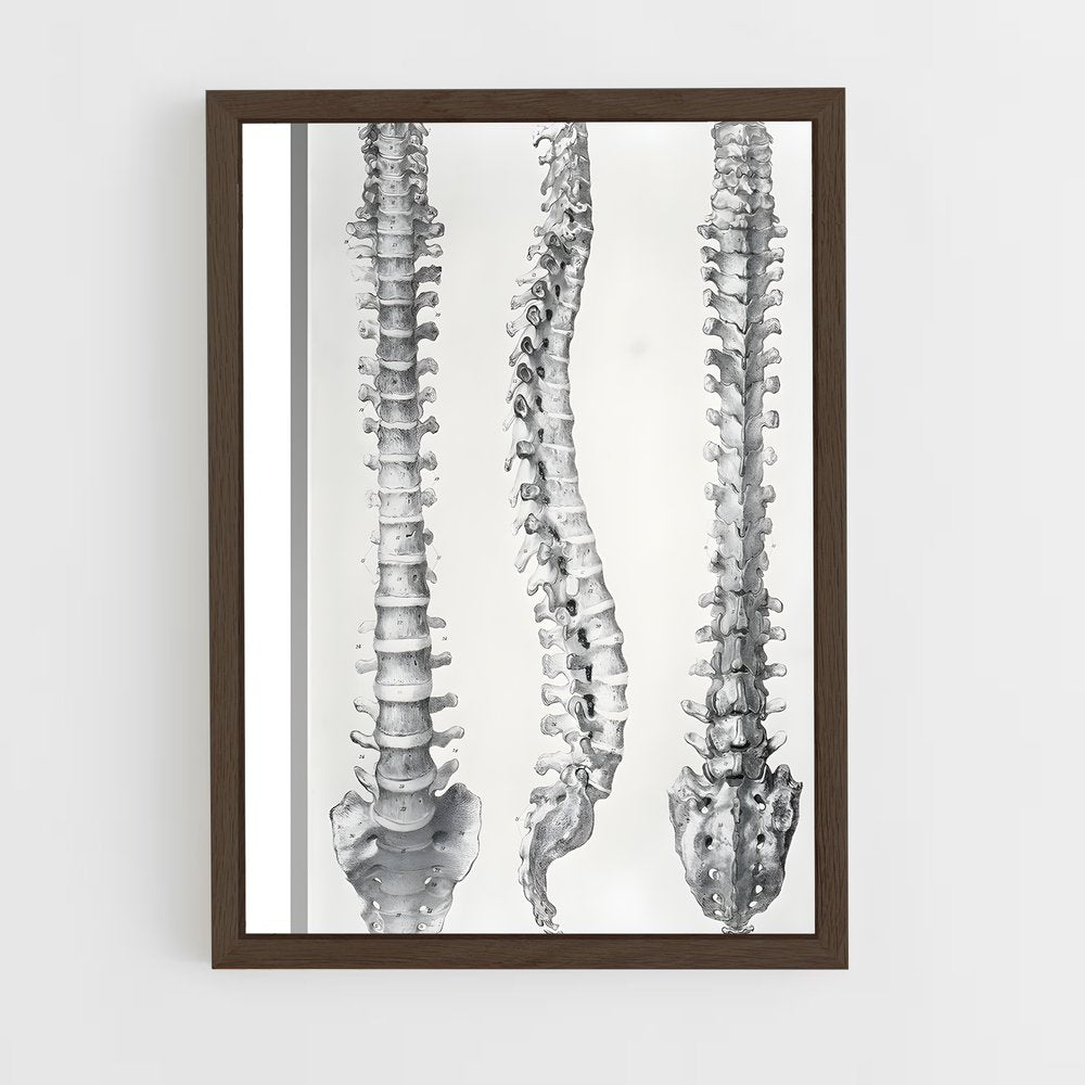 ap-spine-11 cadre Bois foncé