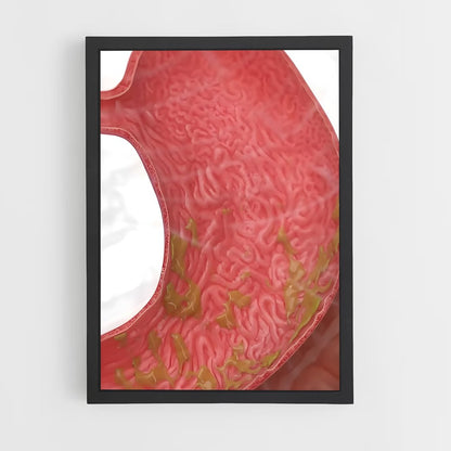 ap-stomach-2 cadre Noir