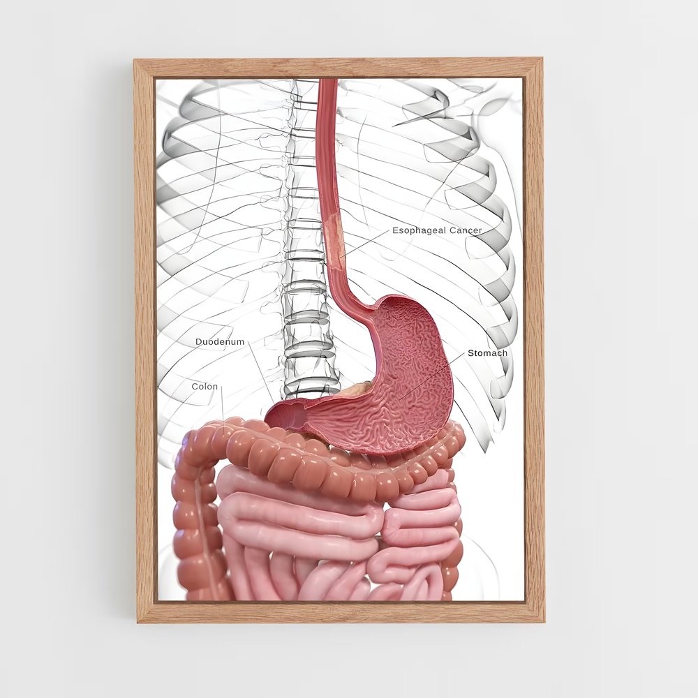 ap-stomach-3 cadre Bois clair