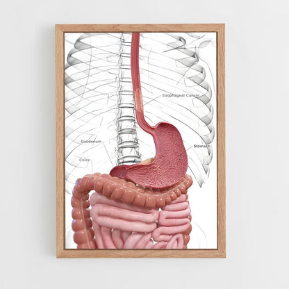 ap-stomach-3 cadre Bois clair