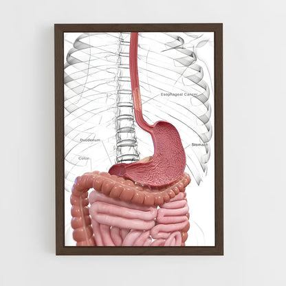 ap-stomach-3 cadre Bois foncé