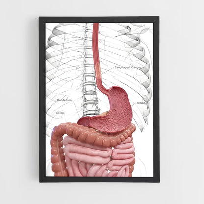 ap-stomach-3 cadre Noir