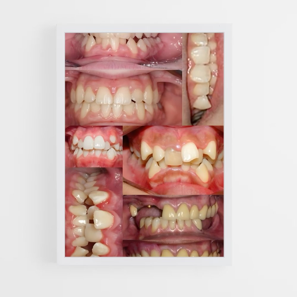 ap-teeth-1 cadre Blanc