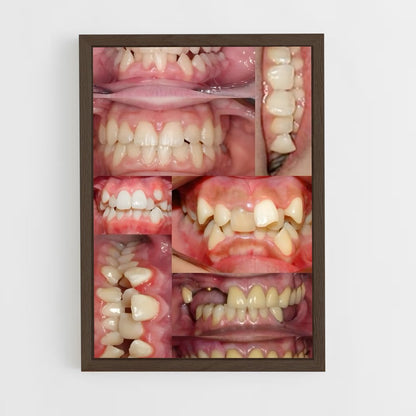 ap-teeth-1 cadre Bois foncé