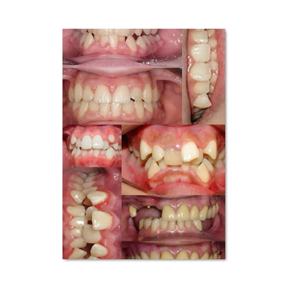 Poster Sourire Étincelant