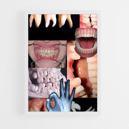 ap-teeth-2 cadre Blanc
