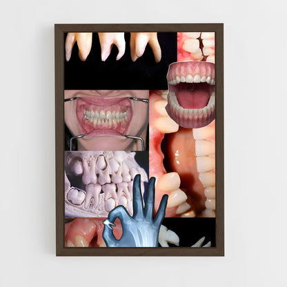 ap-teeth-2 cadre Bois foncé