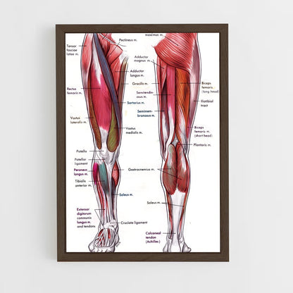 ap-thigh-1 cadre Bois foncé